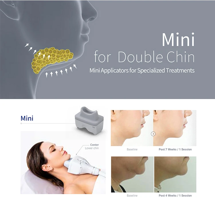 New Released Cryolipolisis Fat Freezing Machine 4