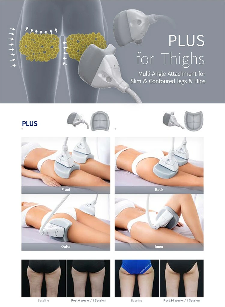 New Released Cryolipolisis Fat Freezing Machine 5