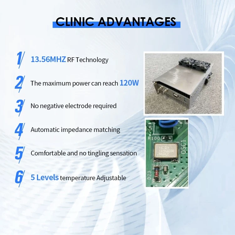 KES rf machine advantage KES rf machine advantage